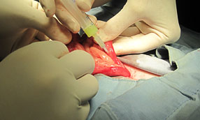 surgical-Insemination